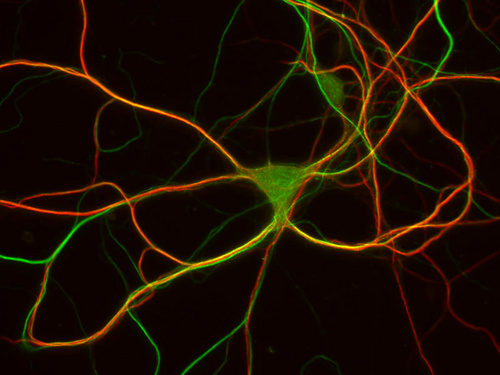 "This is a pyramidal neuron from the hippocampus, a part of the brain where some kinds of memories are formed. This neuron has been labeled with fluorescent antibodies so that we can visualize microtubules (shown in green), which form a structural network