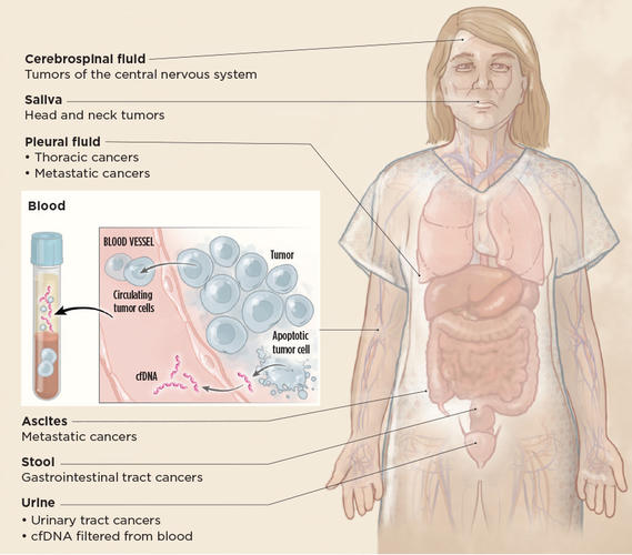 Illustrated Graphic showing the different types of body fluid cancer tests