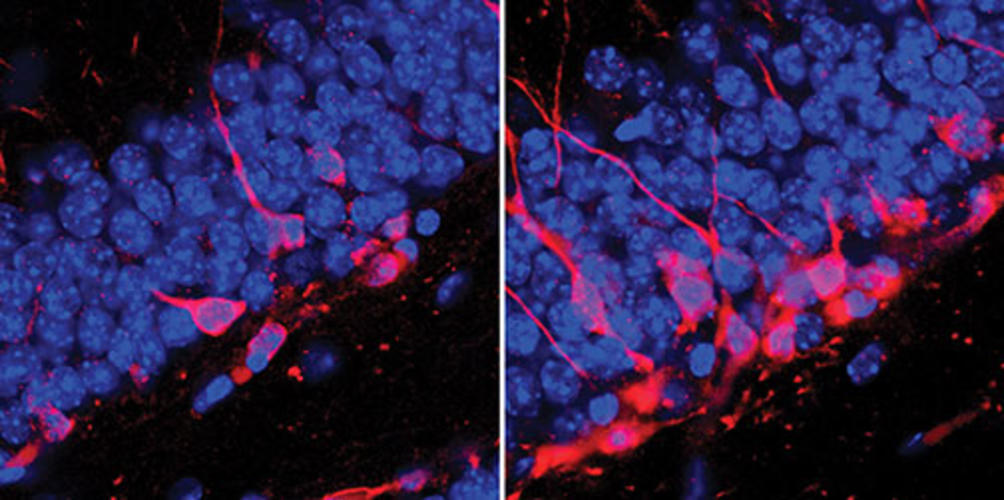 The image on the right shows new neurons (in pink) in the brains of adult mice after spending time in naturalistic settings at the Stony Ford Center. At left are the brains of mice kept in control conditions, showing less adult neurogenesis.