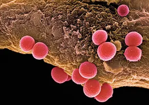 Professor Mark Brynildsen is studying how Staphylococcus aureus bacteria go into a hibernation state that allows them to become tolerant of antibiotics.