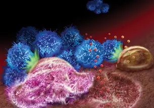 An illustration depicts how breast cancer’s spread to the bone relies on interactions among tumor cells (blue), specialized bone cells that break down the bone (pink), specialized cells that rebuild bone tissue (brown), and the bone matrix.