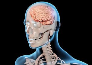 Image from presentation on traumatic brain injuries.
