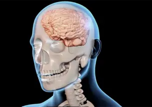 This image of a brain appeared in a Research Day presentation on traumatic brain injuries.