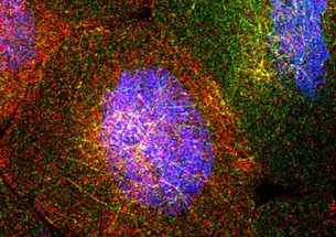 little.jpg The fruit fly ovary consists of about 100 egg chambers. Each chamber contains 15 "nurse cells." These surround the oocyte, or egg cell, which ultimately will develop into a baby fruit fly. The nurse cells synthesize RNA molecules that are ultimately depos