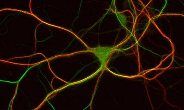 "This is a pyramidal neuron from the hippocampus, a part of the brain where some kinds of memories are formed. This neuron has been labeled with fluorescent antibodies so that we can visualize microtubules (shown in green), which form a structural network