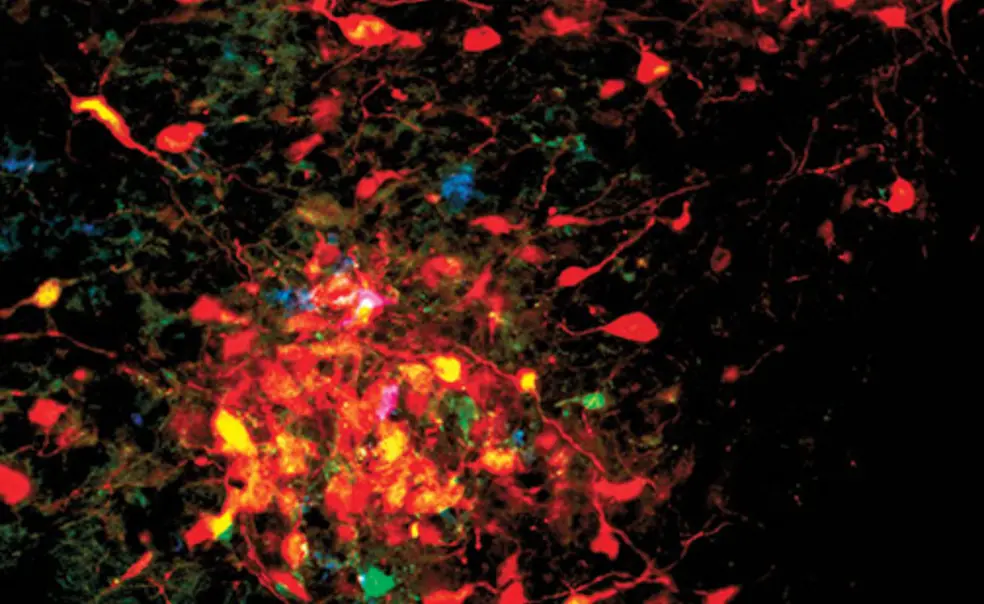 Brainbow.jpg
