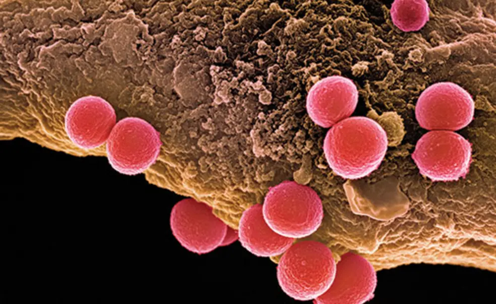 Antibiotic Resistance: Invasion of the Superbugs