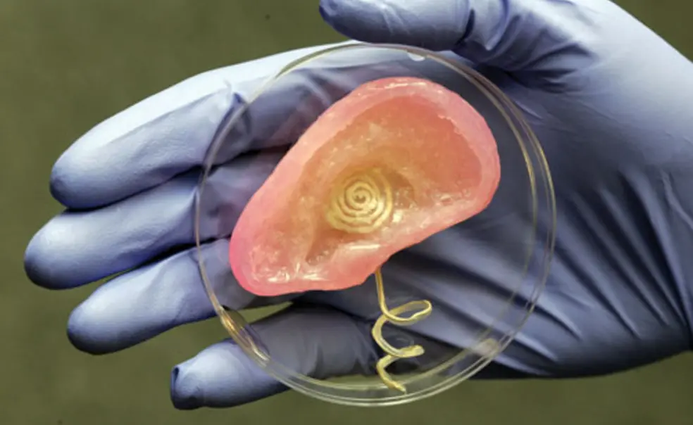 Listen up: Research team uses 3-D printer to create bionic ear Listen up: Research team uses 3-D printer to create bionic ear