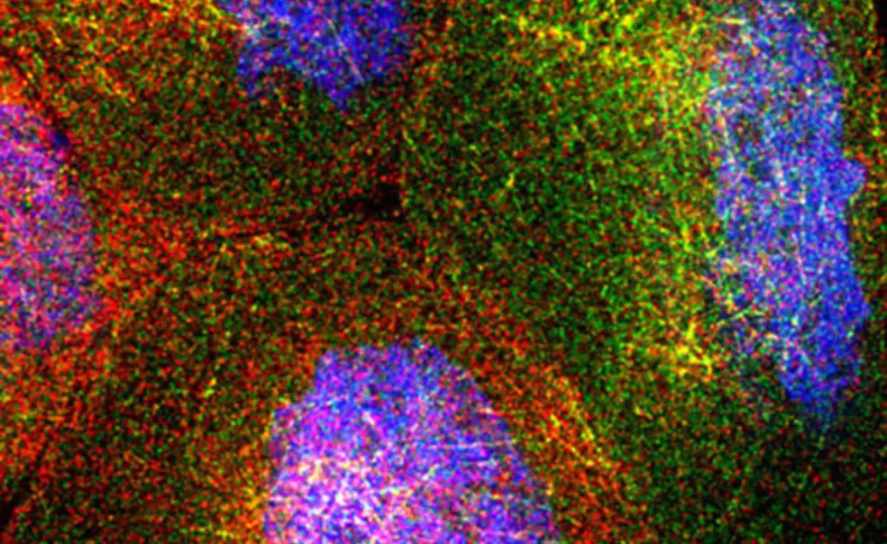 Slide Show: Fruit Flies Under the Microscope Slide Show: Fruit Flies Under the Microscope