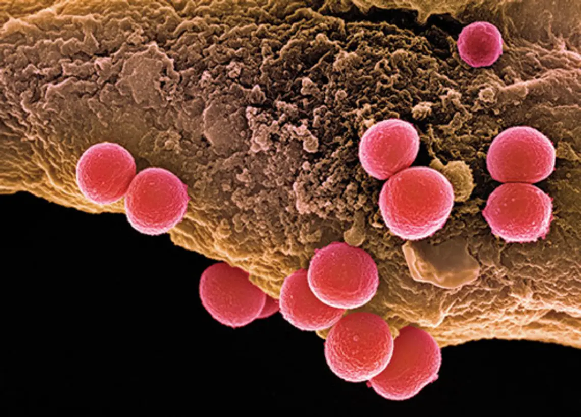 MIND-StaphylococcusAureusBacteria.jpg Professor Mark Brynildsen is studying how Staphylococcus aureus bacteria go into a hibernation state that allows them to become tolerant of antibiotics.
