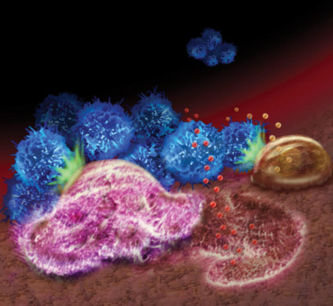 An illustration depicts how breast cancer’s spread to the bone relies on interactions among tumor cells (blue), specialized bone cells that break down the bone (pink), specialized cells that rebuild bone tissue (brown), and the bone matrix.