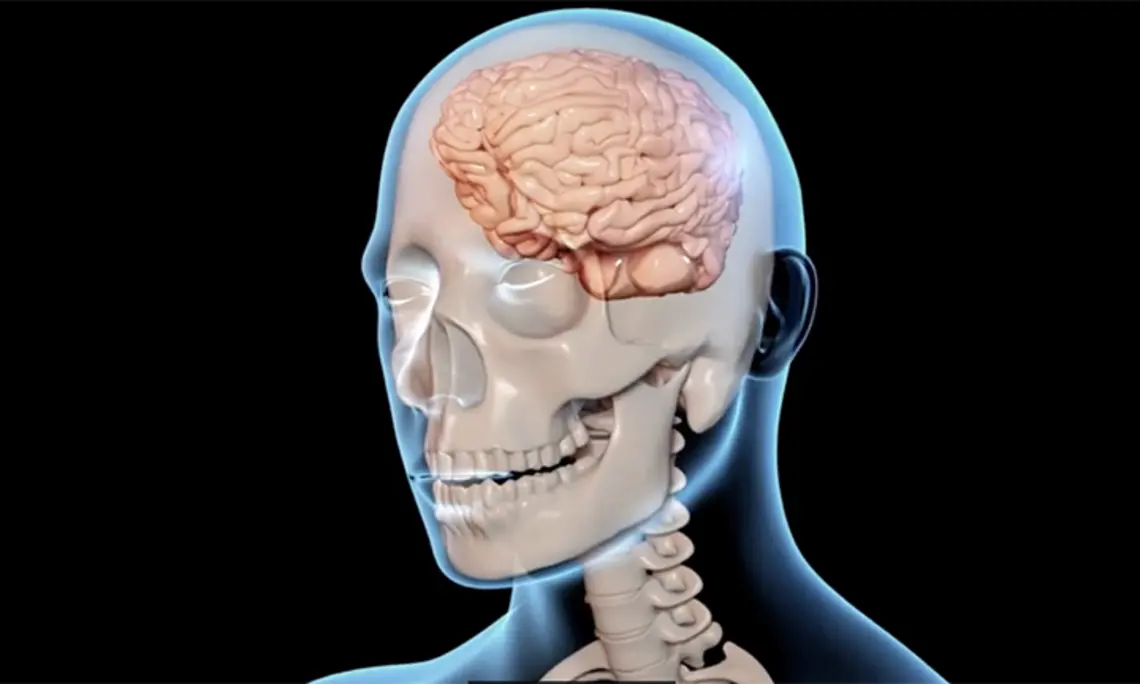 ResearchDay.png This image of a brain appeared in a Research Day presentation on traumatic brain injuries.