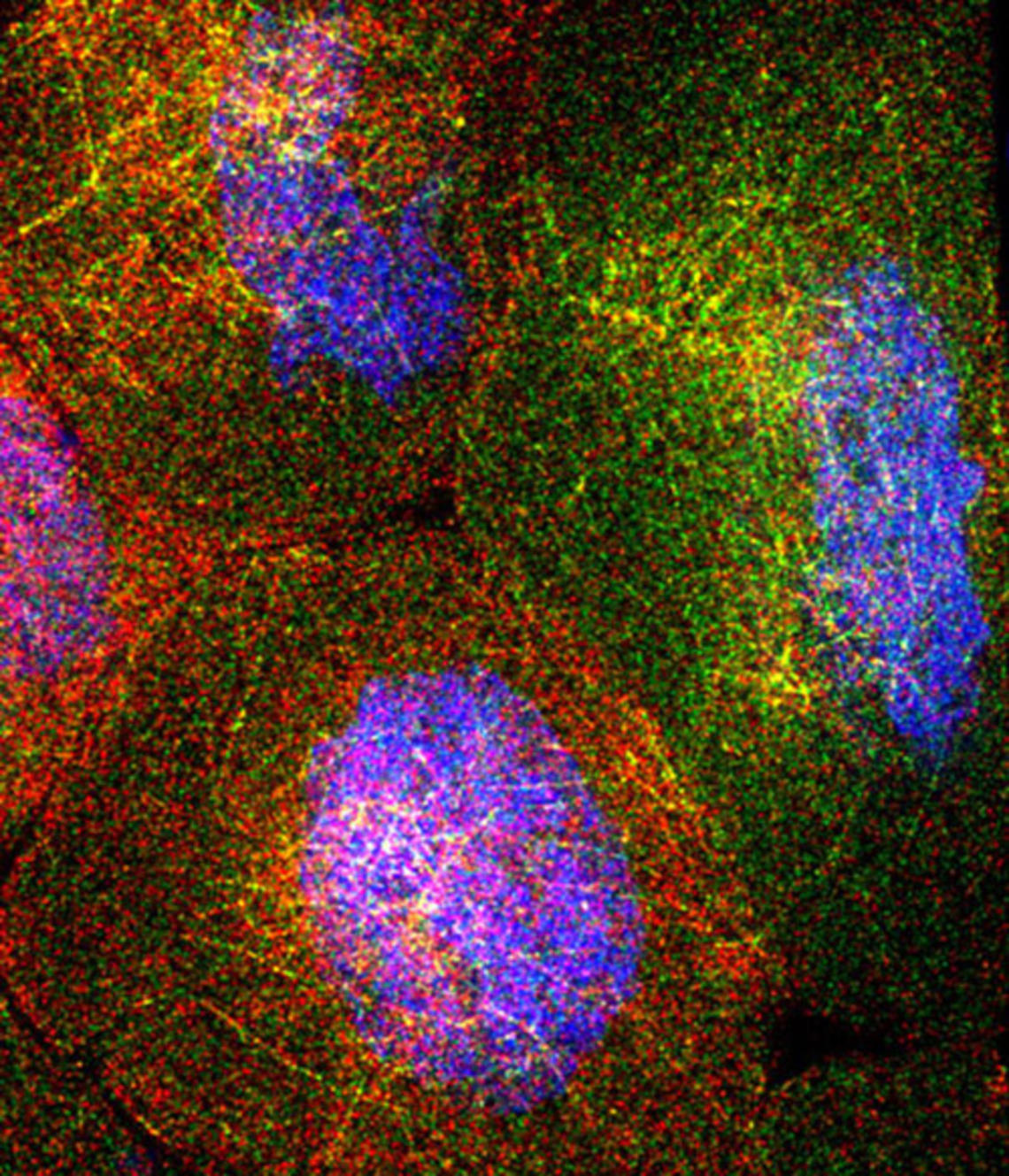 The fruit fly ovary consists of about 100 egg chambers. Each chamber contains 15 "nurse cells." These surround the oocyte, or egg cell, which ultimately will develop into a baby fruit fly. The nurse cells synthesize RNA molecules that are ultimately depos