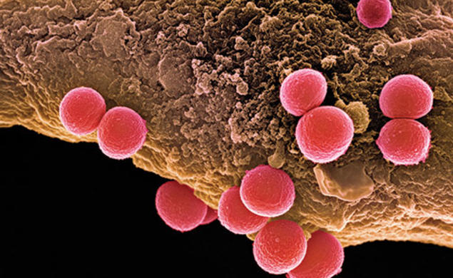 Professor Mark Brynildsen is studying how Staphylococcus aureus bacteria go into a hibernation state that allows them to become tolerant of antibiotics.