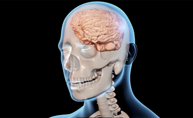 This image of a brain appeared in a Research Day presentation on traumatic brain injuries.