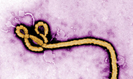 Ebola Abridged: New Technology May Restrain Outbreaks of Infectious Diseases