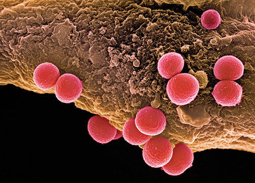 Professor Mark Brynildsen is studying how Staphylococcus aureus bacteria go into a hibernation state that allows them to become tolerant of antibiotics.