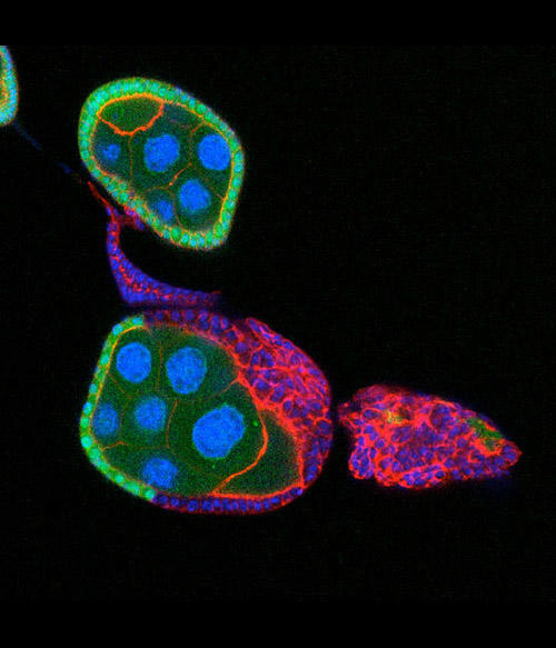 Schüpbach's work also explores mutations that affect the embryo. In this image, a normal egg chamber on top has a single layer of wildtype (green) follicle cells surrounding the nurse cells and oocyte. In the egg chamber at the bottom, the mutant follicl